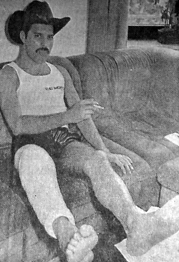 Freddie recovering from his knee injury in 1984